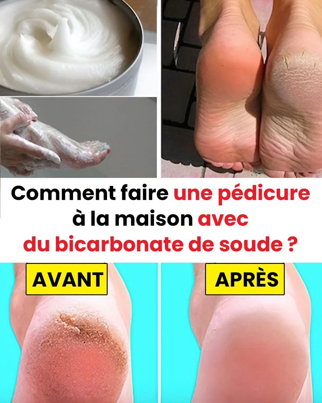 Comment réaliser une pédicure à la maison avec du bicarbonate de soude ? Commentaires