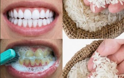 Le secret que les dentistes vous cachent pour retrouver des dents blanches en 60 secondes. Tout est dans le premier commentaire !