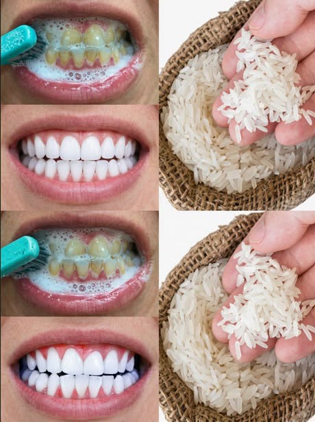 Le secret que les dentistes vous cachent pour retrouver des dents blanches en 60 secondes. Tout est dans le premier commentaire !
