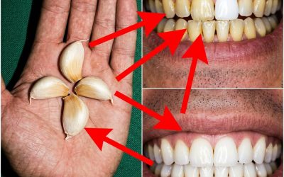 Comment blanchir les dents avec de l’ail : l’astuce qui surprend tout le monde ⤵️