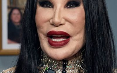 Elle était une actrice célèbre, ayant joué dans une centaine de films, mais une erreur tragique a complètement ruiné son apparence. Beaucoup sont surpris en découvrant son visage d’avant… Regardez dans les commentaires pour voir ⬇
