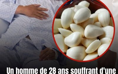 Il a mangé de l'ail chaque jour pendant 5 mois — ce qui est arrivé à ses reins a stupéfié les médecins 😳