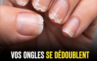 Des ongles cassants ou fragiles peuvent signaler... voir plus