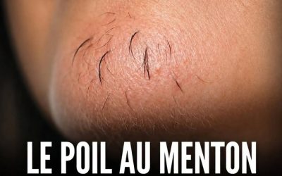 Le poil de menton chez une femme est le signe de… Voir plus