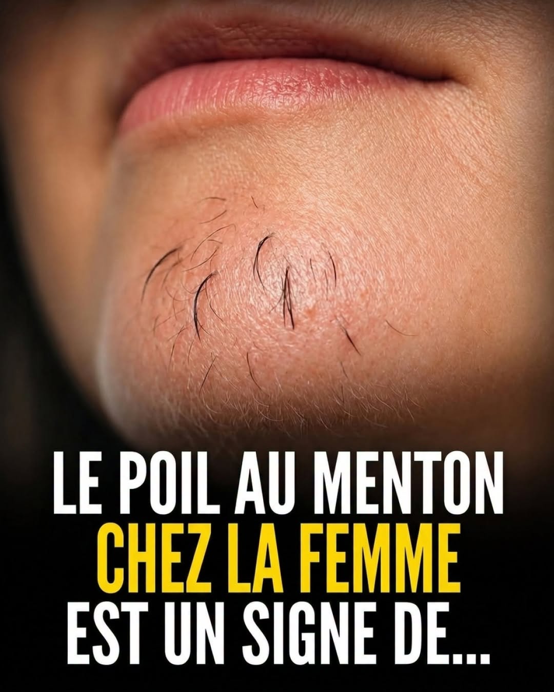 Le poil de menton chez une femme est le signe de… Voir plus