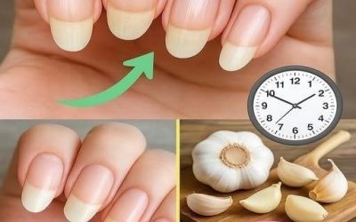 L’ail, un secret beauté méconnu pour fortifier vos ongles en seulement 5 minutes