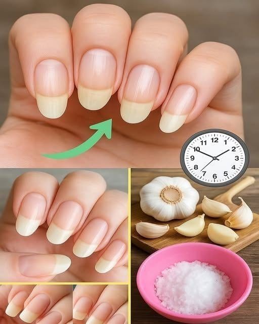 L’ail, un secret beauté méconnu pour fortifier vos ongles en seulement 5 minutes